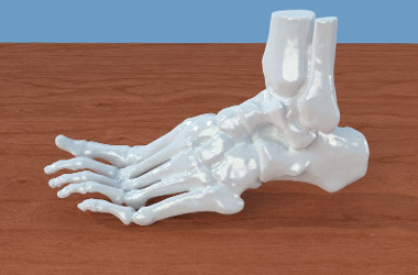 Создано новое покрытие для костных имплантатов